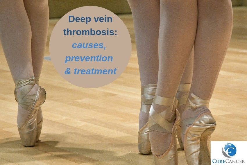Deep vein thrombosis: causes, symptoms, and prevention