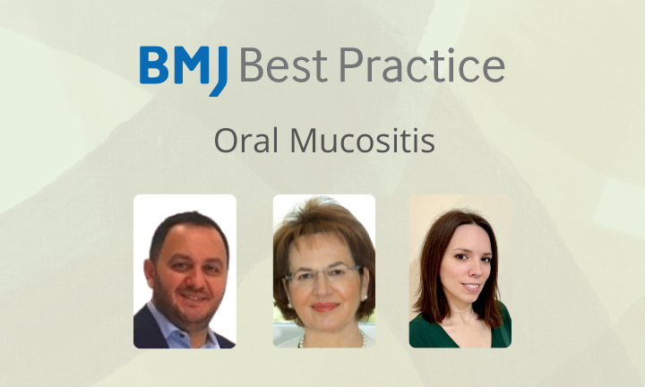 What is oral mucositis (stomatitis) in chemotherapy?